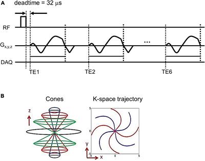 Feasibility of ultrashort echo time quantitative susceptibility mapping with a 3D cones trajectory in the human brain